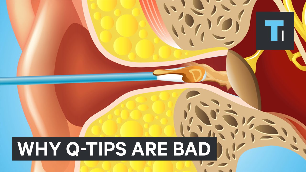 Voici pourquoi ne pas vous devriez jamais nettoyer vos oreilles avec un